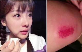 受伤明星,明星康复之路漫漫